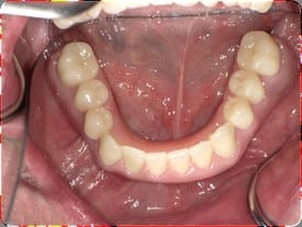 Thompson Advanced Dentistry treatment results