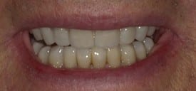 Thompson Advanced Dentistry treatment results
