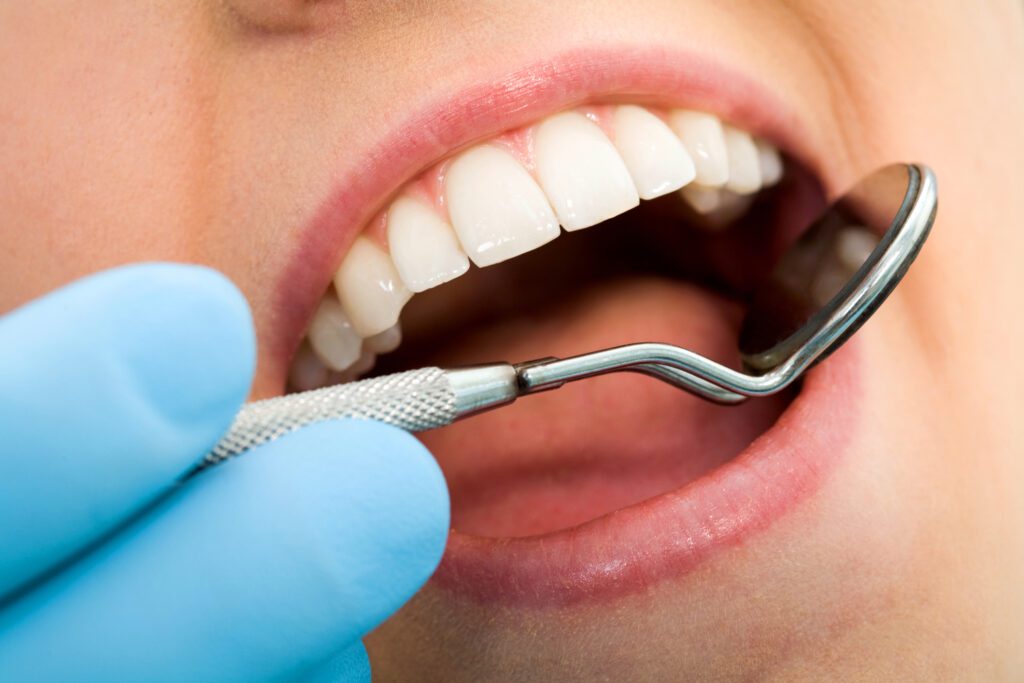 Treatment for a Chipped Tooth in Greeley, CO