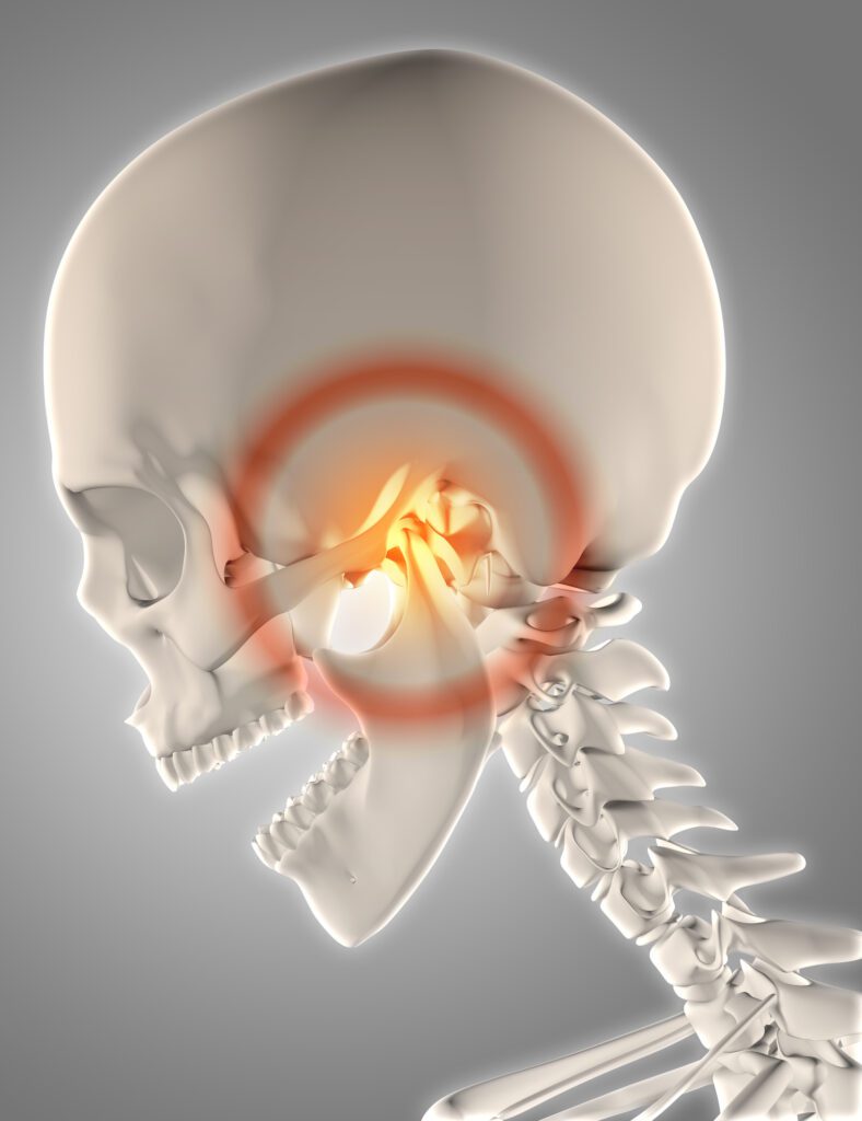 Treatment for TMJ headaches in Greeley, CO