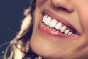 Why Fix Your Smile Alignment