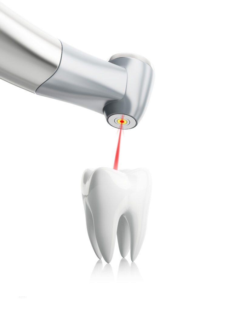 Laser Dentistry in Greeley, CO